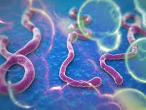 Ebola kendini böyle gösteriyor