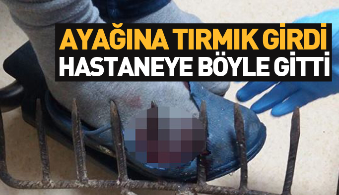 Ayağına saplanan tırmıkla hastaneye gitti