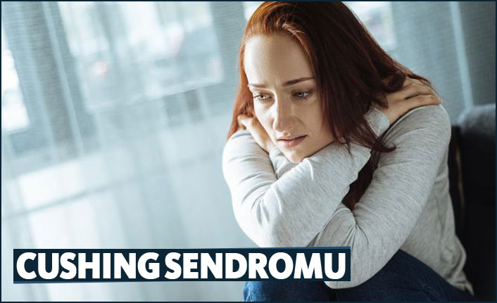 Cushing sendromu/hastalığı nedir?