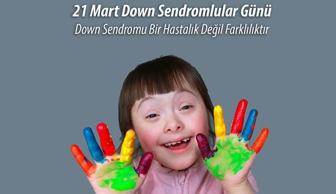 “Down Sendromu hastalık değil farklılıktır”