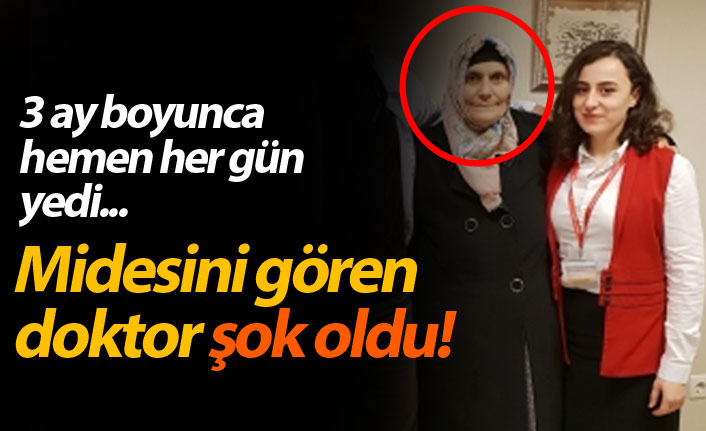 3 ay boyunca hemen hemen her gün yedi, midesinde oluşan şok etti!