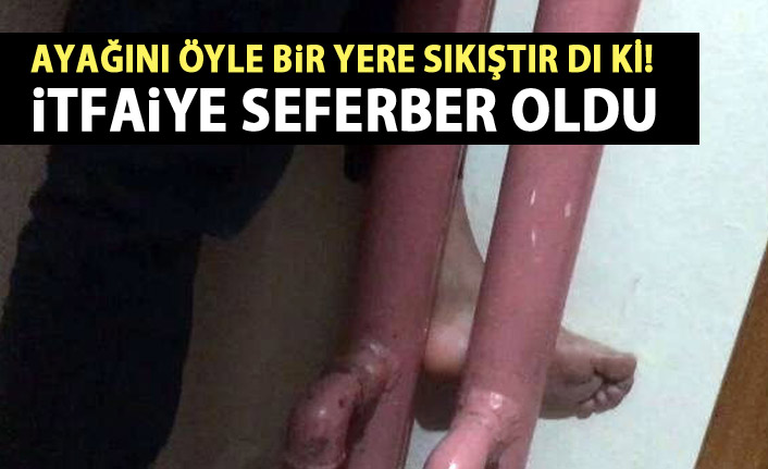 Ayağını öyle bir yere soktu ki itfaiye seferber oldu!