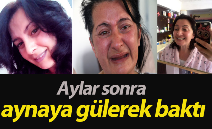 1,5 yıl sonra tekrar aynaya baktı