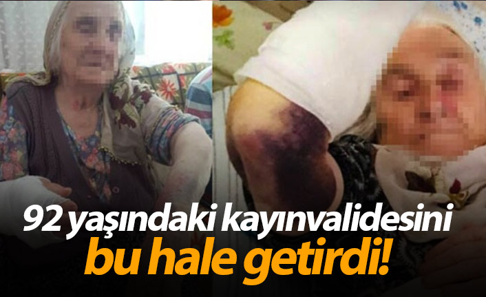 Samsun'da gelin dehşeti! Kayınvalidesini bu hale getirdi