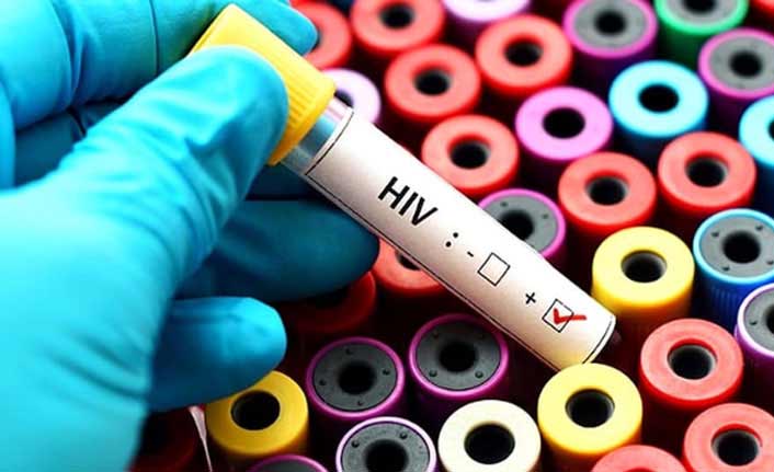 Türkiye’de HIV virüsü en sık o yaşlar arasında görülüyor!