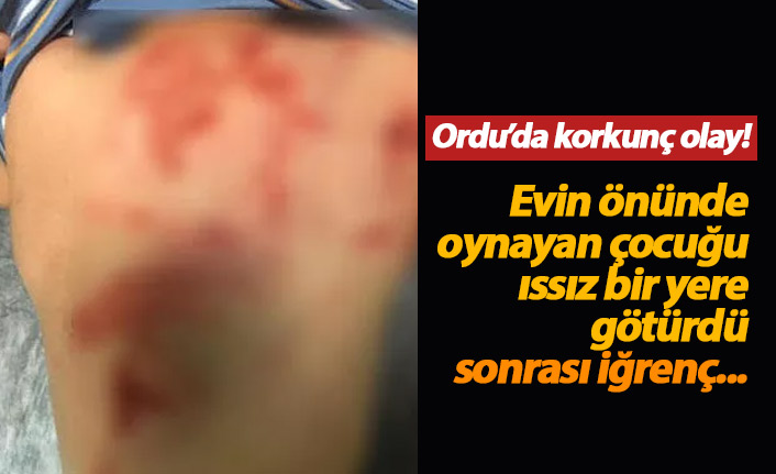 Küçük çocuğu darp edip cinsel istismarda bulundu