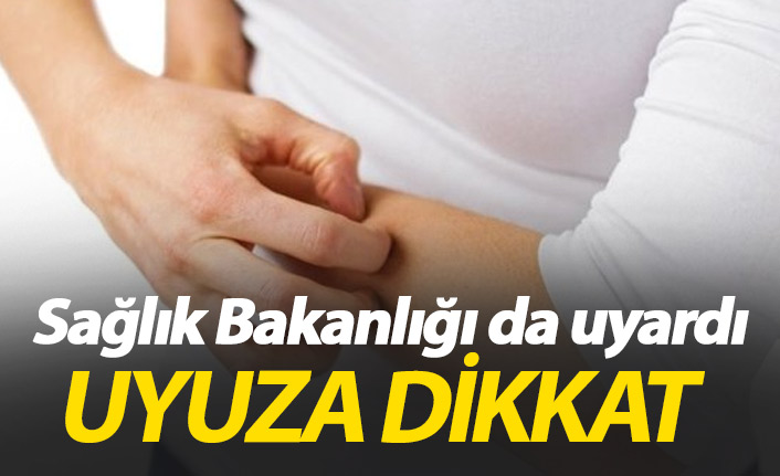 Sağlık Bakanlığı da uyardı uyuz hastalığına dikkat