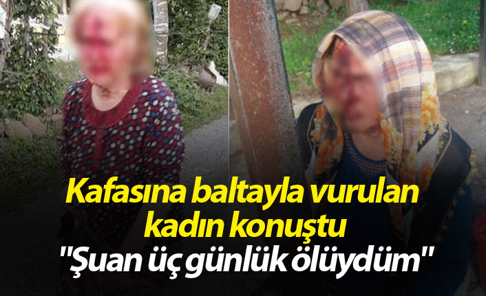 Kafasına baltayla vurulan kadın konuştu; "Şuan üç günlük ölüydüm"