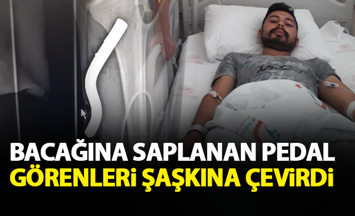 Bacağına motosiklet parçası saplandı