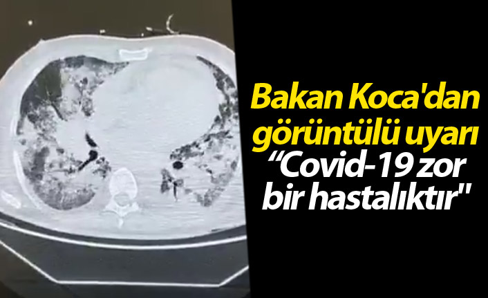 Bakan Koca'dan görüntülü uyarı: "Covid-19 zor bir hastalıktır"