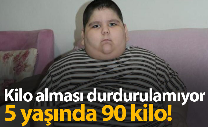 Kilo alması durdurulamıyor! 5 yaşında 90 kilo