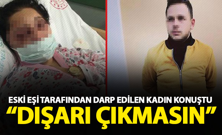 Eski eşi tarafından darp edilen kadın konuştu