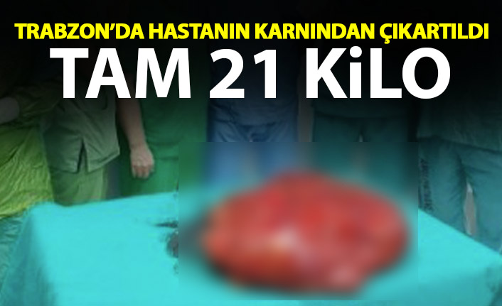 Trabzon'da hastanın karnından 21 kilo tümör çıktı