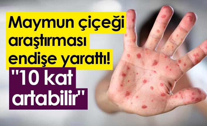 Maymun çiçeği araştırması endişe yarattı! "10 kat artabilir"