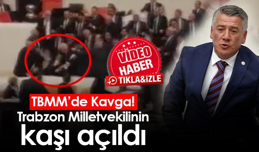 TBMM’de Kavga! Trabzon Milletvekili'ne yumruklu saldırı