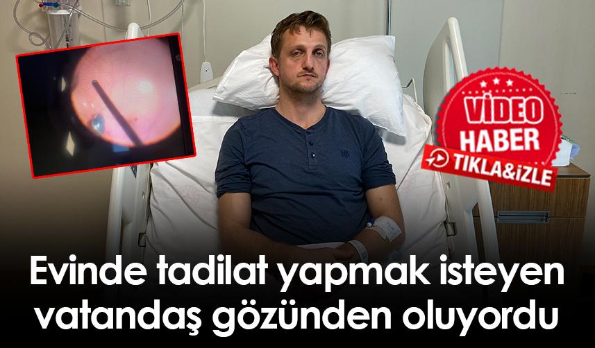 Evinde tadilat yapmak isteyen Rizeli vatandaş gözünden oluyordu