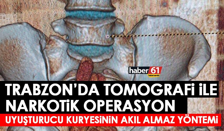 Trabzon’da uyuşturucu kaçakçısının akıl almaz yöntemi! Tomografi sonrası yakalandı