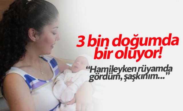 Bebek böyle doğdu! 3 binde bir görülüyor...