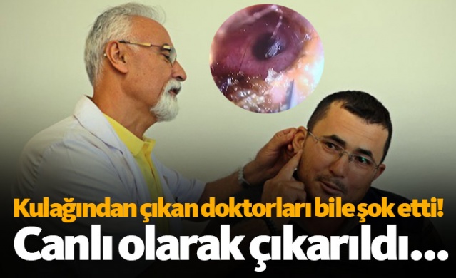 Kulağından canlı olarak çıktı, doktorlar da şaşırdı