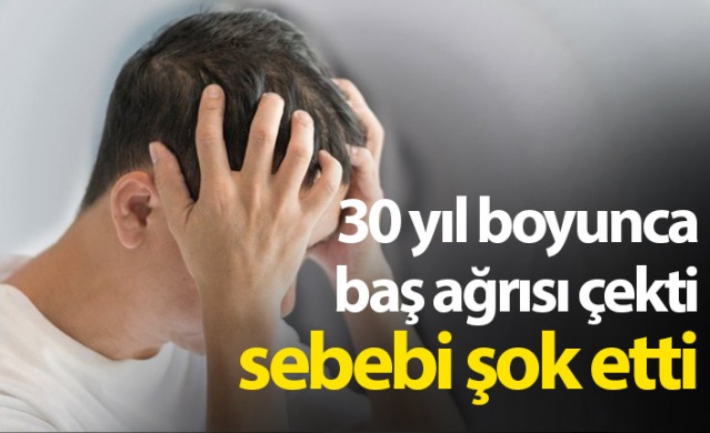 30 yıl boyunca baş ağrısı çekti sebebi şok etti. Foto Galeri