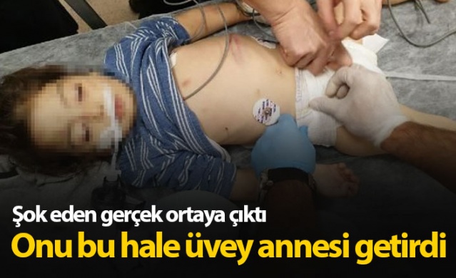 Şok gerçek ortaya çıktı!  Onu bu hale üvey annesi getirdi...