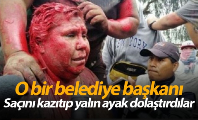 O bir belediye başkanı! Saçını kazıtıp yalın ayak dolaştırdılar