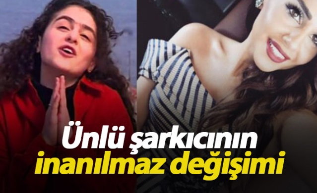 Günel'in son hali şaşırttı