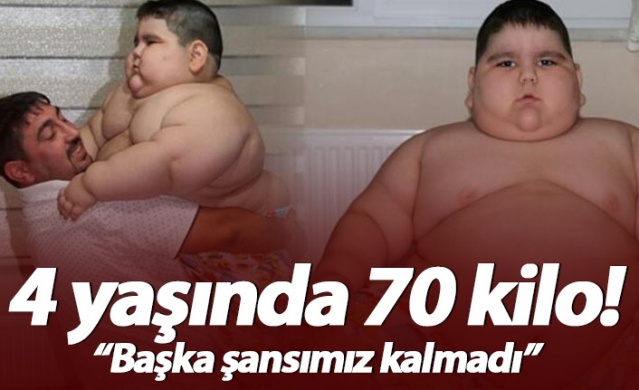 4 yaşında 70 kilo!