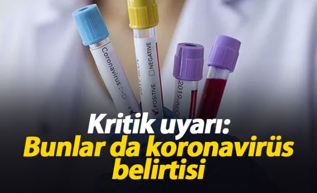 Dikkat bunlar da koronavirüs belirtisi