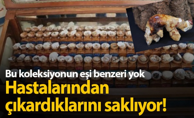 İnanılmaz koleksiyon! Hastalarından çıkardıklarını saklıyor