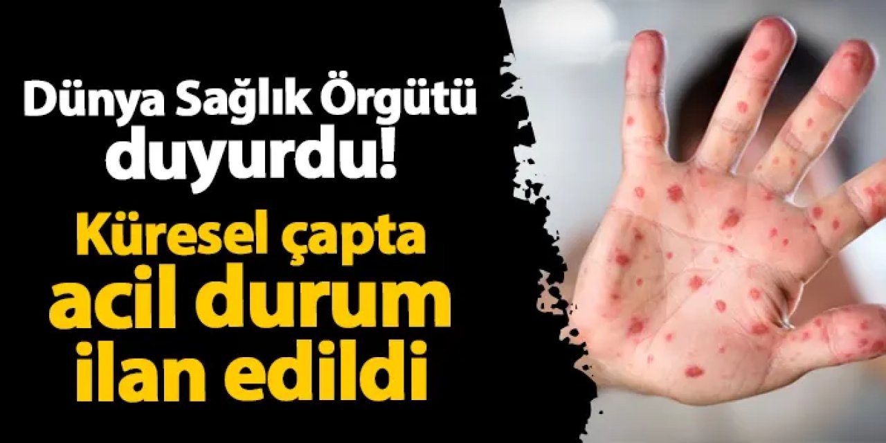 Dünya Sağlık Örgütü duyurdu! Küresel çapta acil durum ilan edildi