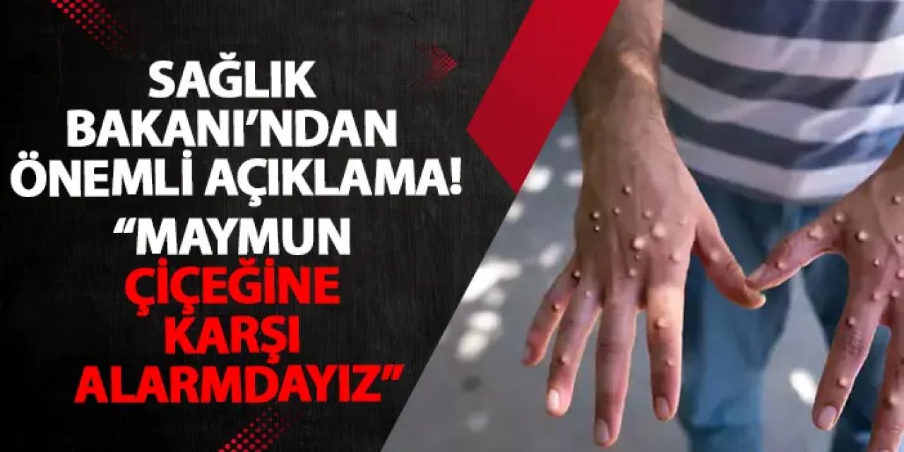 Sağlık Bakanı’ndan önemli açıklama! “Maymun çiçeğine karşı alarmdayız”