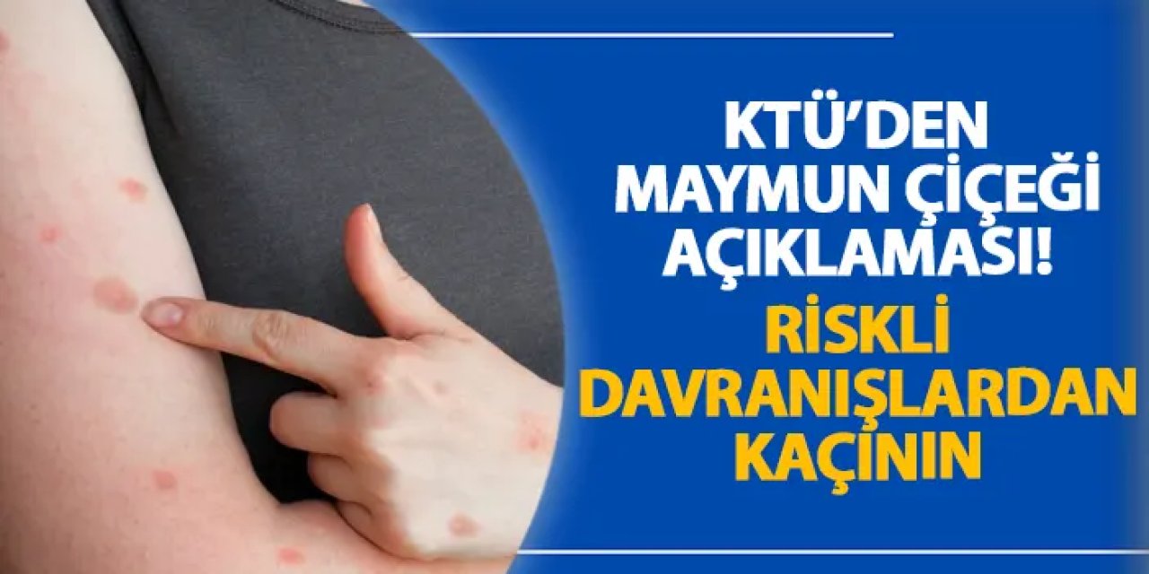 KTÜ’den maymun çiçeği açıklaması! Riskli davranışlardan kaçının