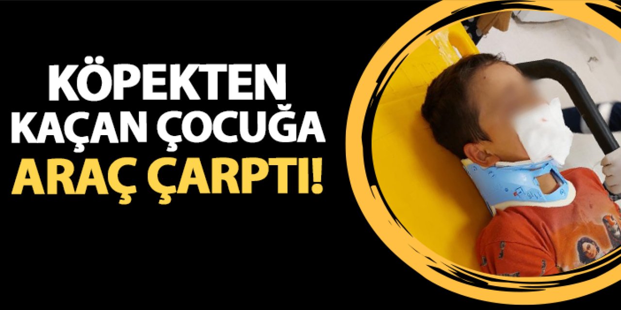 Samsun'da köpekten kaçan çocuğa araç çarptı!