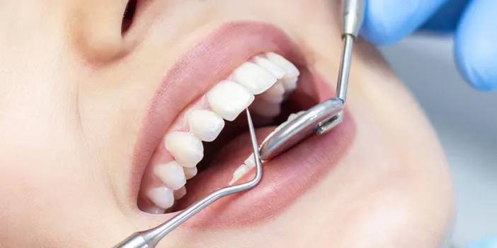 Periodontoloji nedir? Periodontoloji neye bakar?