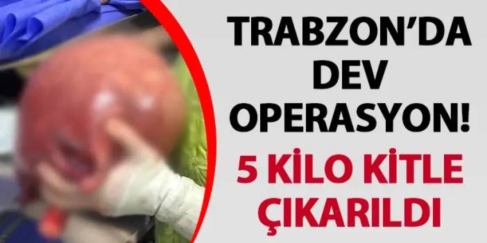 Trabzon’da dev operasyon! 5 kilo kitle çıkarıldı