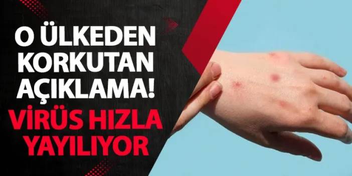 O ülkeden korkutan açıklama! Virüs hızla yayılıyor