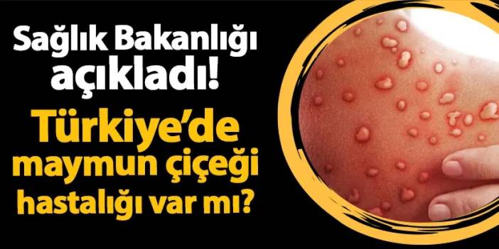 Sağlık Bakanlığı açıkladı! Türkiye'de maymun çiçeği hastalığı var mı?