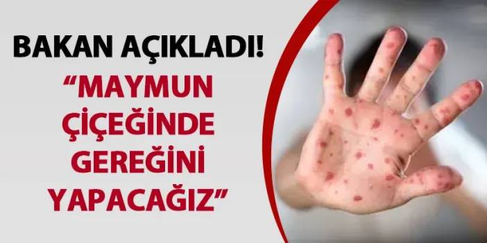 Bakan açıkladı! “Maymun çiçeğinde gereğini yapacağız”