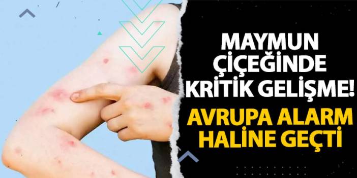 Maymun çiçeğinde kritik gelişme! Avrupa alarm haline geçti