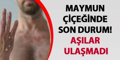 Maymun çiçeğinde son durum! Aşılar ulaşmadı